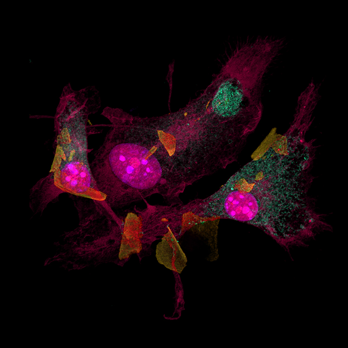 The inner nebula of microglia by Alison Carlisle