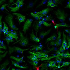 Neural precursor cells form into neurospheres, which then differentiate into astrocytes and new neurons.